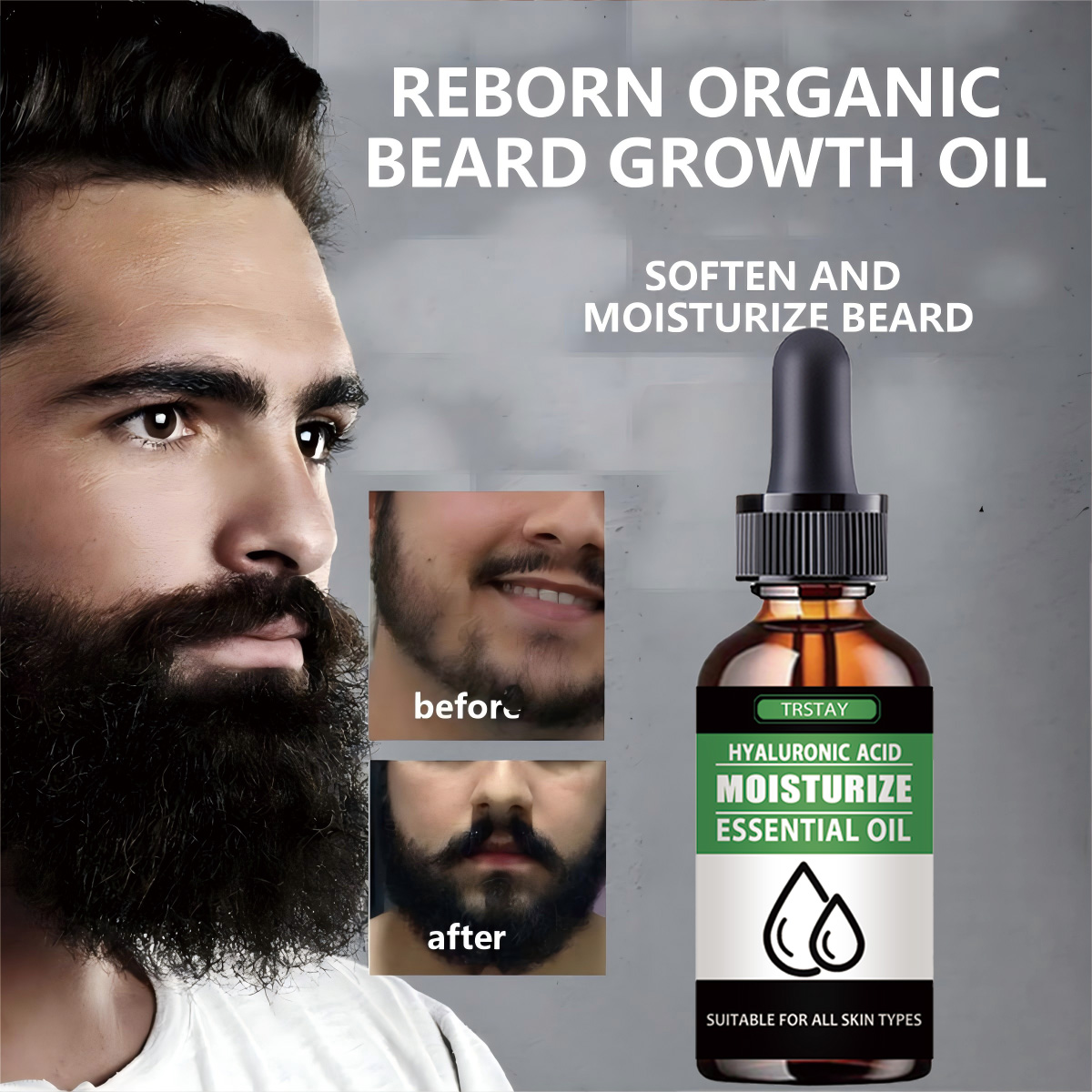 Men'S Grooming Product - 100%Natural Accelerate Facial Hair Grow Beard